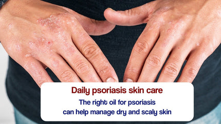 Oil for Psoriasis – Psoriasis Care with Dr. JRK’s 777 Oil