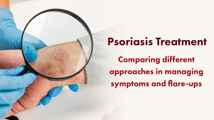 Psoriasis Treatment: Comparing Different Approaches in Managing Symptoms and Flare-Ups