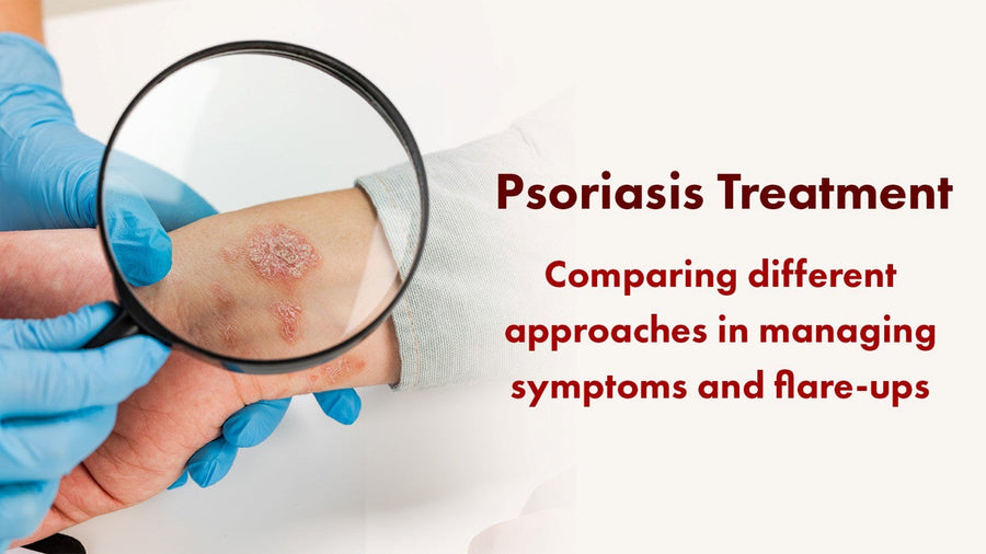 Psoriasis Treatment: Comparing Different Approaches in Managing Symptoms and Flare-Ups