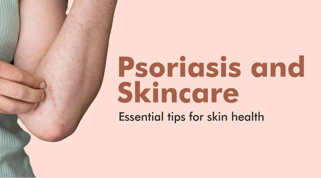 Psoriasis and Skincare| Essential tips for skin health