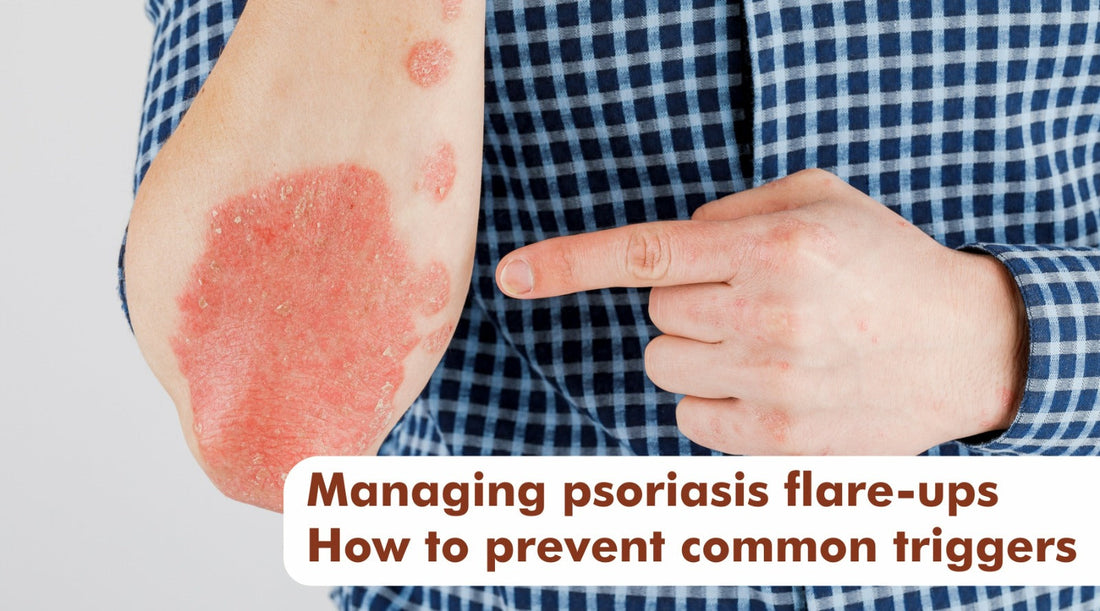 Oil for psoriasis, Dr.JRK’s 777 oil