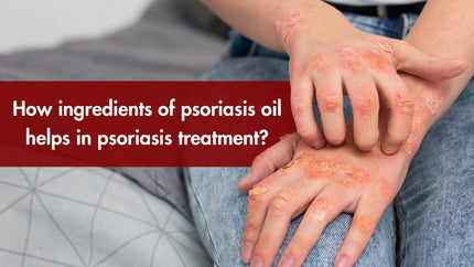 Best psoriasis treatment oil 