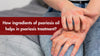 Best psoriasis treatment oil 