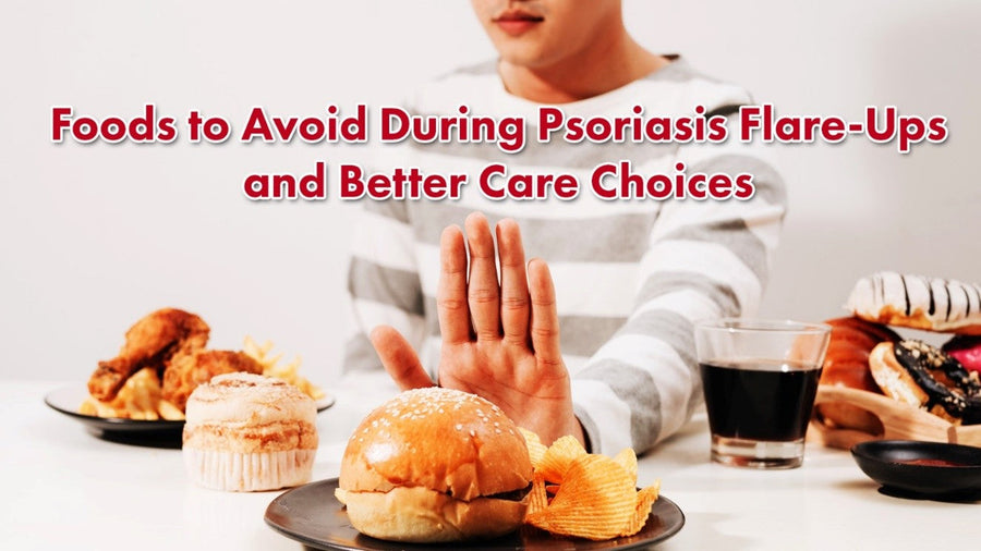 Foods to Avoid During Psoriasis Flare-Ups