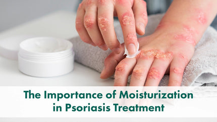 The Importance of Moisturization in Psoriasis Treatment