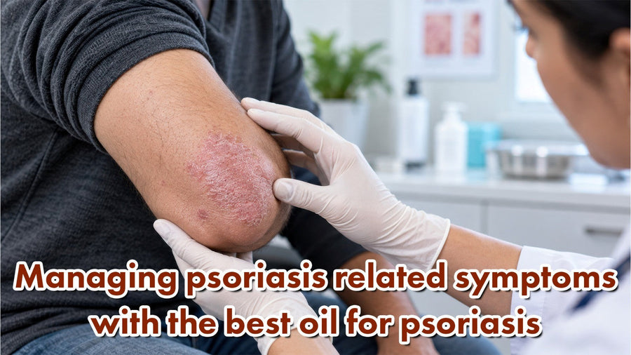 Managing Psoriasis-Related symptoms with the best Oil for Psoriasis