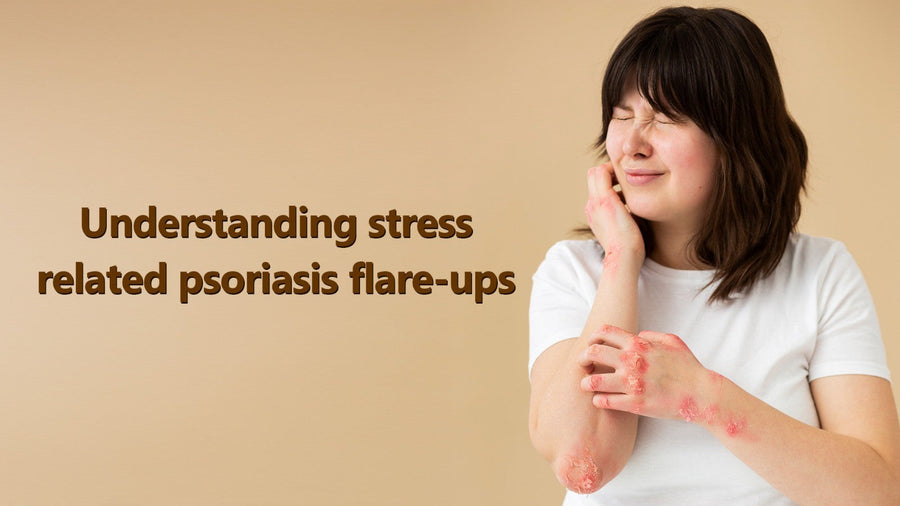 Understanding Stress-Related Psoriasis Flare-Ups